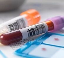 Diagnosi di laboratorio di prostatite