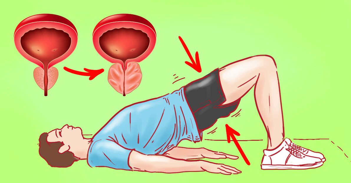 Esercizi terapeutici in prostatite cronica