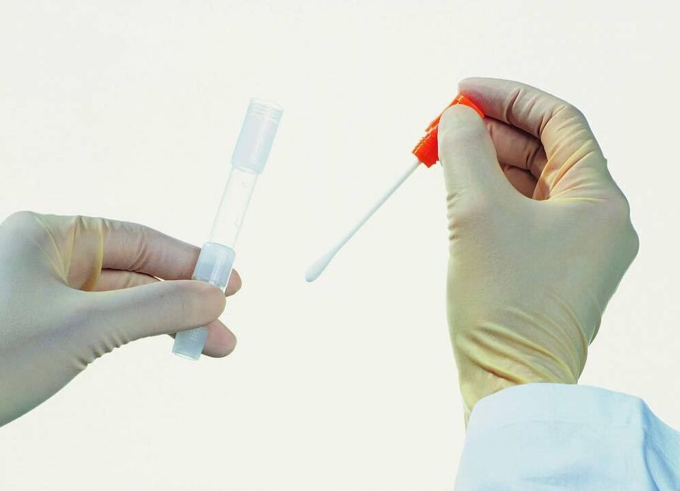 Raccolta di analisi per il rilevamento della prostatite cronica