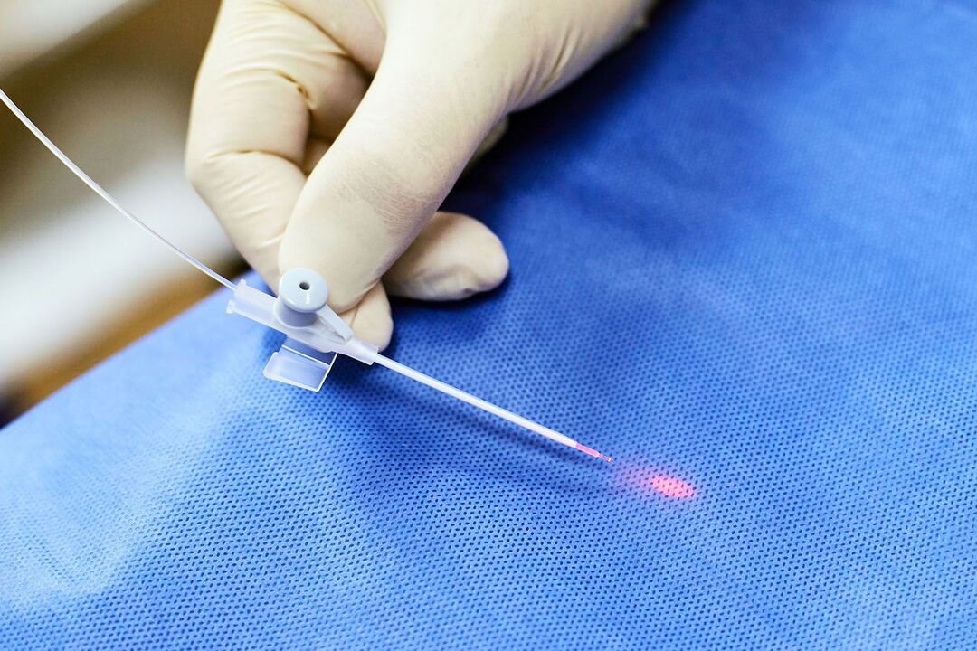 Dispositivo transrettale per il trattamento della prostata